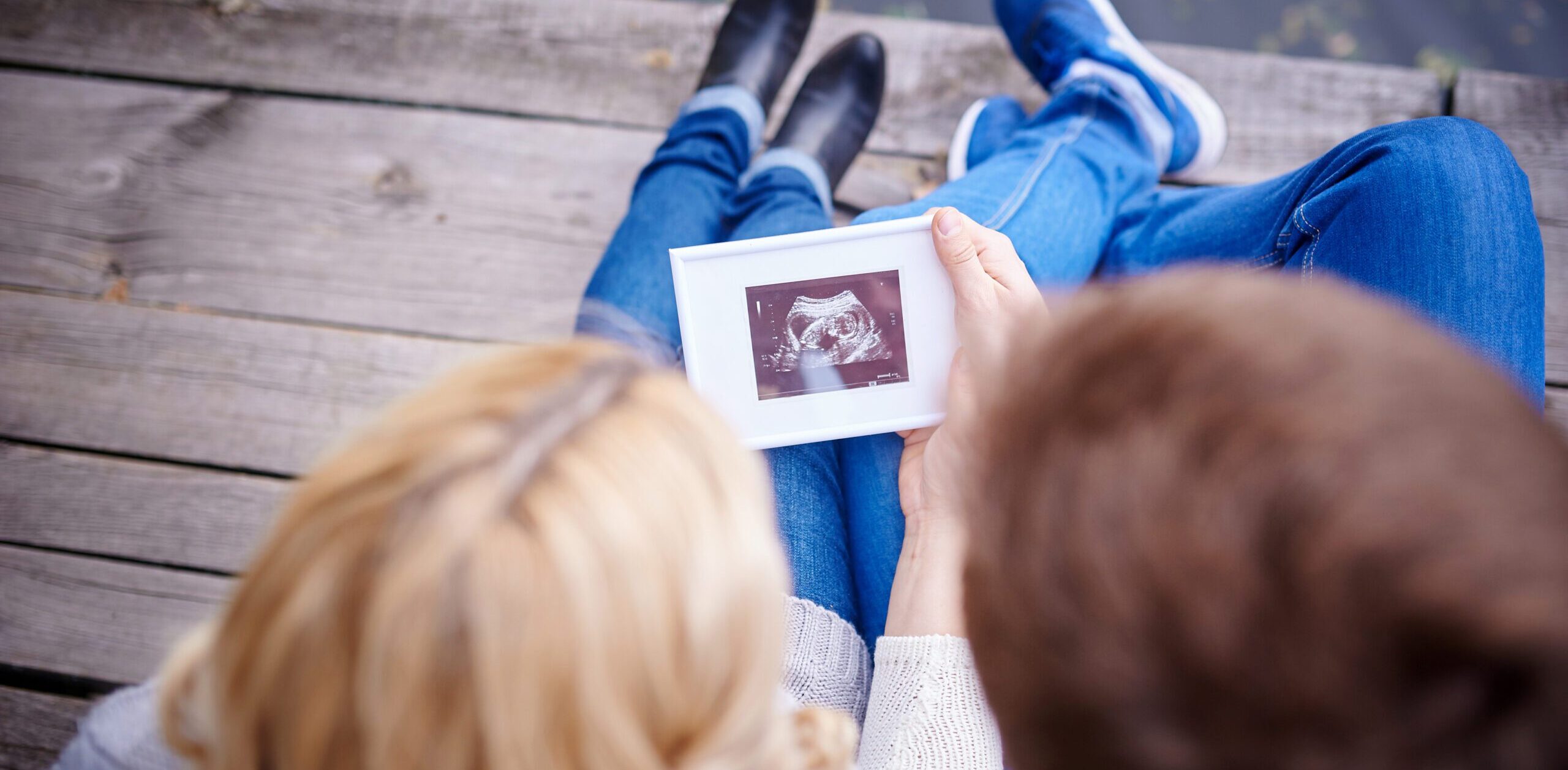 Happy Couple Are Holding Ultrasound Scan Of Their Baby