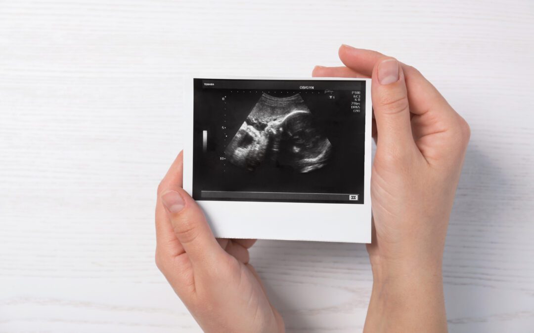 The Undeniable Impact of Ultrasound