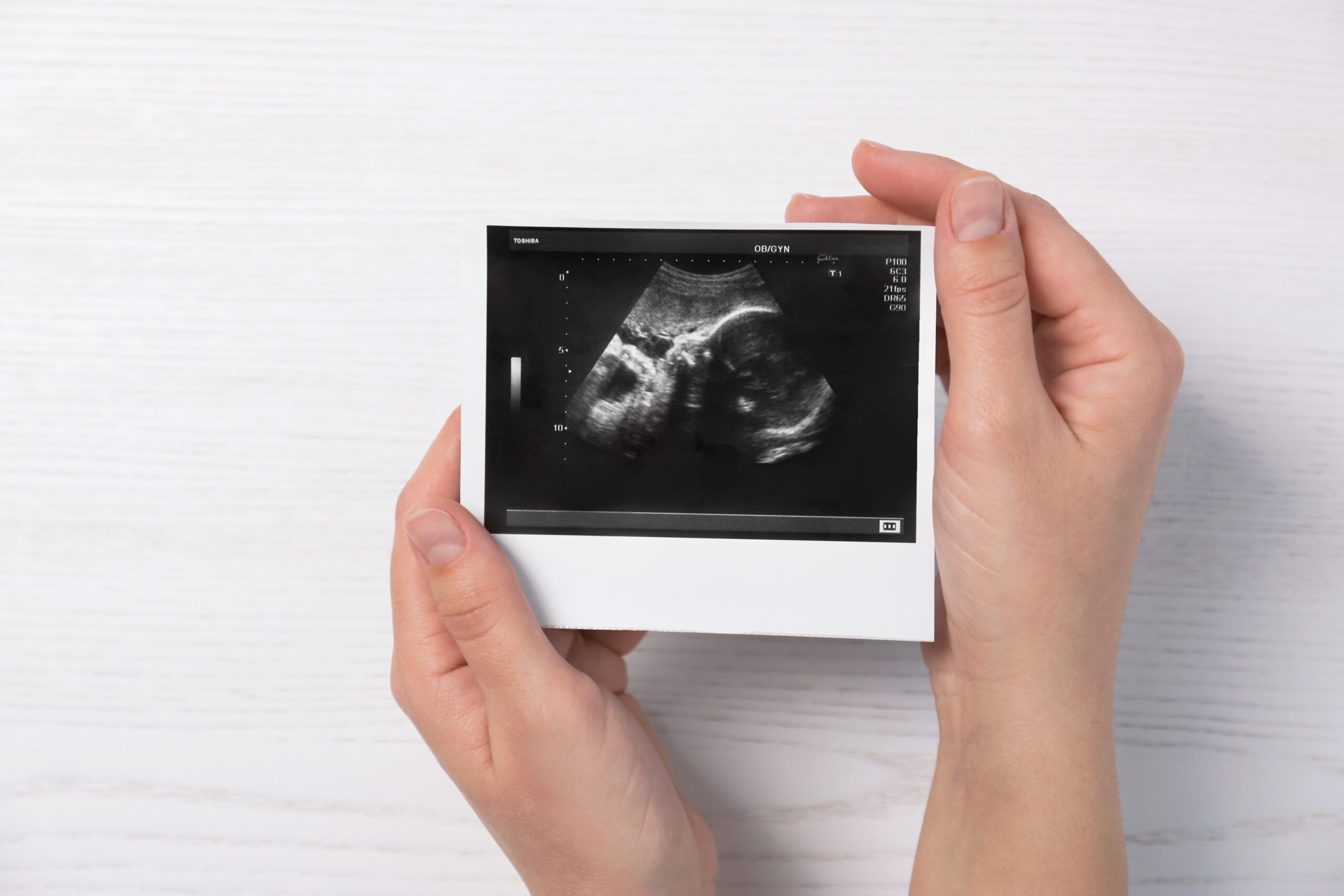 Woman holding ultrasound photo. Shows the impact of ultrasound.